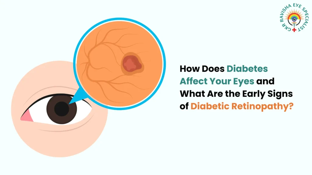 How Diabetes Affects Your Eyes